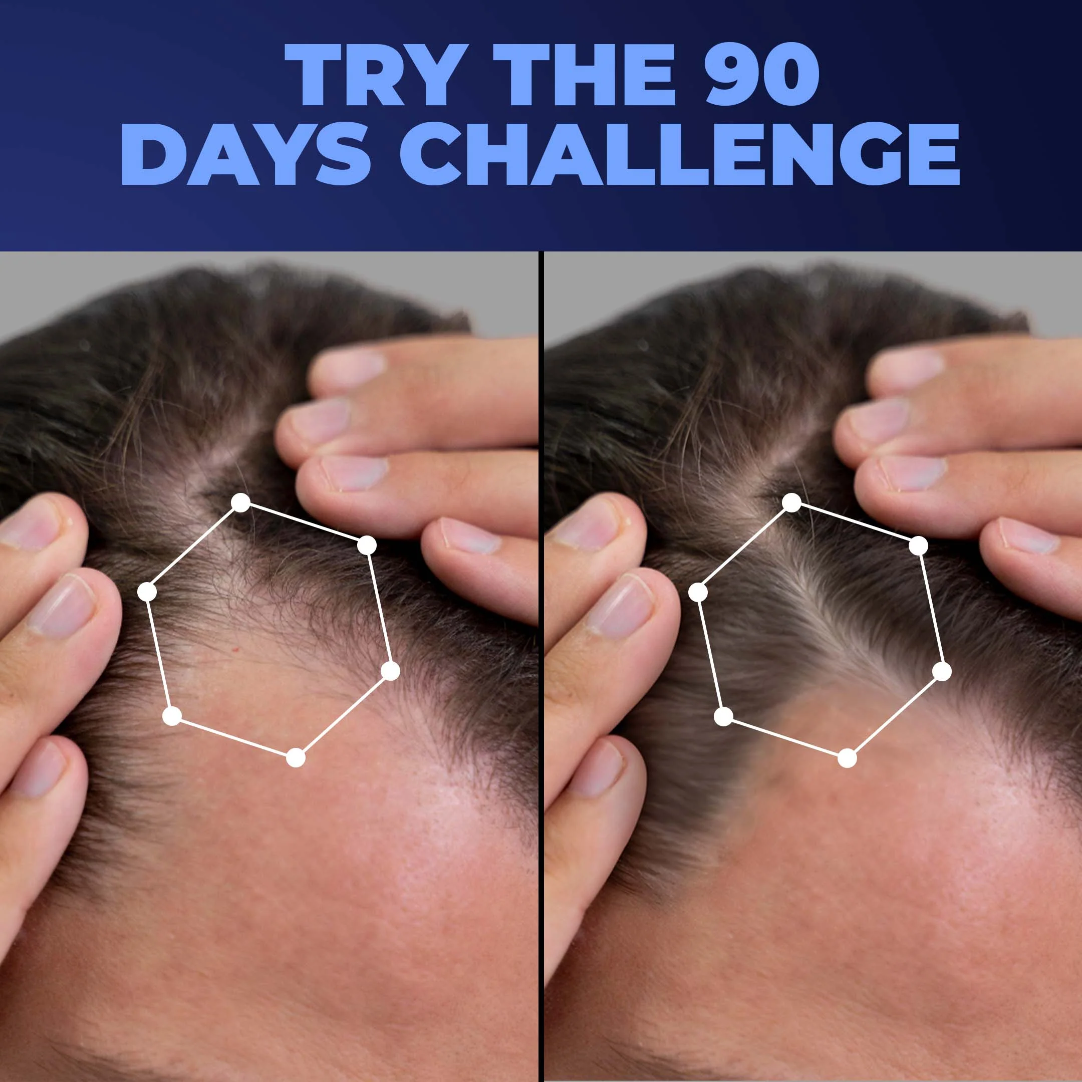 Advanced Hair Growth Duo - Image 9